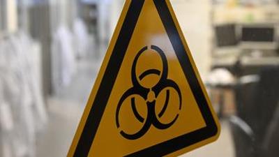 nano: Forscher graben Geheimnis des Schwarzen Todes aus | NANO
