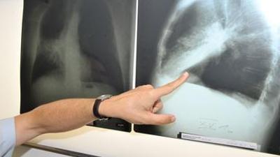 nano: Unsichtbares Gas, echtes Krebsrisiko: Radon in Wohnräumen | NANO