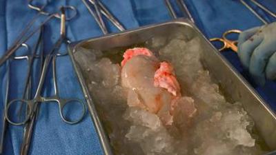 nano: vom 28. Mai 2024: Xenotransplantationen - Wie weit ist die Forschung? nano: vom 28. Mai 2024: Xenotransplantationen - Wie weit ist die Forschung?