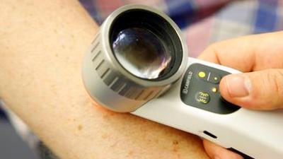 nano: Eine Impfung gegen Hautkrebs?