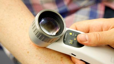 nano: Eine Impfung gegen Hautkrebs?
