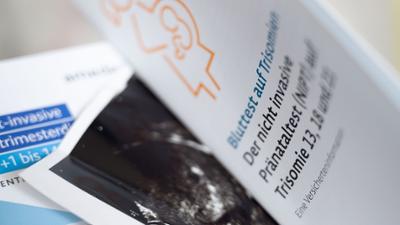 Tagesgespräch: Wissen oder nicht wissen: Was halten Sie von Pränataltests?