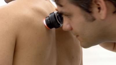 treffpunkt medizin: Unsere Haut · Schattenseiten des Sonnenlichts treffpunkt medizin: Unsere Haut · Schattenseiten des Sonnenlichts