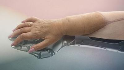 Die neue Hand - Geschichte einer Transplantation