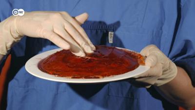 Die Plazenta: übersehenes Superorgan der Schwangerschaft