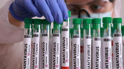Hantavirus - Droht eine neue Pandemie?