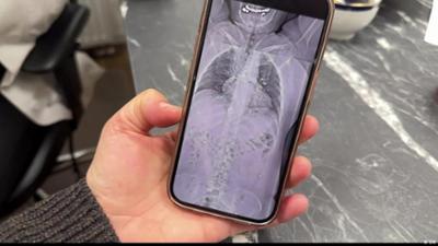 Proteste im Iran: Telemedizin aus Deutschland für Verletzte