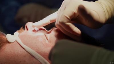 Ukraine: Ein neues Gesicht und ein neues Leben für Artem