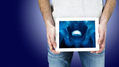 Die Gesundmacher: Unter der Gürtellinie - mit dem Urologen im OP