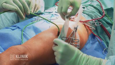 Die Klinik - Ärzte, Helfer, Diagnosen: Gezielte Vergiftung: riskante Heilmethode gegen Krebs