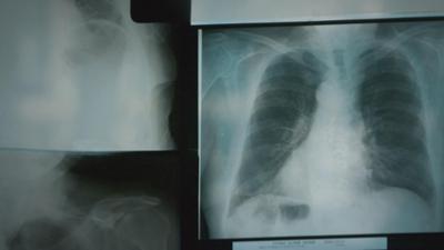 Lügen, die Geschichte schrieben: Staffel 5, Folge 1: Der Asbest-Skandal