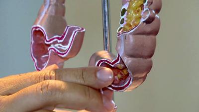 Bauchgehirn & Lebenszentrum: Der Darm: Treffpunkt Medizin