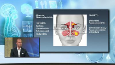 Chronische Sinusitis - Ihre Fragen: MERYN am Montag