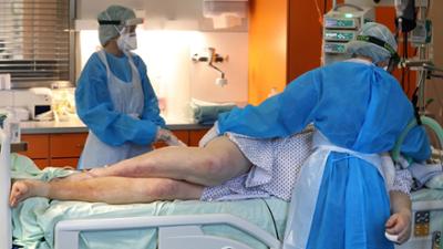 dokumentationen: phoenix plus: Medizin im Grenzbereich - Die Intensivstation