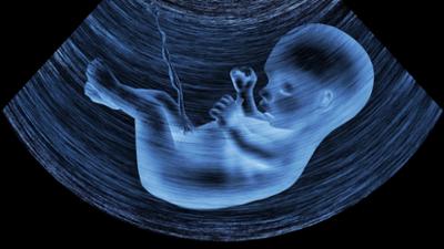phoenix plus: Leihmutterschaft · Baby um jeden Preis?