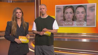 taff: Schauspielerin Denise Richards macht Facelift öffentlich