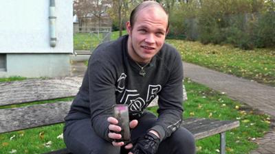 Hartz und herzlich: Staffel 9, Folge 11: Haarausfall