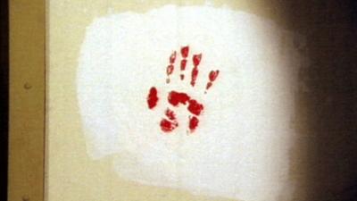 X-Factor: Das Unfassbare: Die blutige Hand | Stumme Hilferufe | Die Flucht | Das Rezept | Ein Alptraum