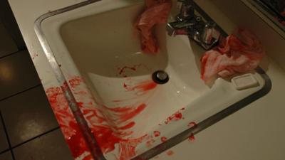 Dr. G - Beruf: Gerichtsmedizinerin: Staffel 1 Folge 10 Ashes to Ashes Dr. G - Beruf: Gerichtsmedizinerin: Staffel 1 Folge 10 Ashes to Ashes