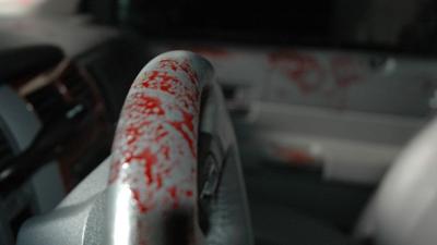 Dr. G - Beruf: Gerichtsmedizinerin: Staffel 1 Folge 12 Dying to be Young