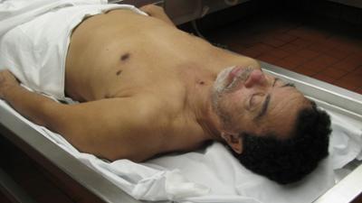 Dr. G - Beruf: Gerichtsmedizinerin: Staffel 4 Folge 18 Fatal Twist