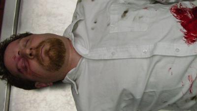 Dr. G - Beruf: Gerichtsmedizinerin: Staffel 4 Folge 16 Last Gasps