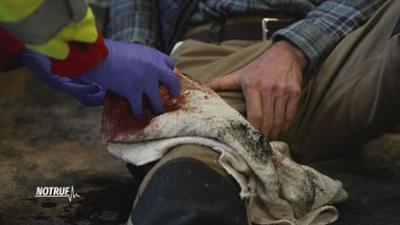 NOTRUF: Blutiges Bein und brennende Bronchien