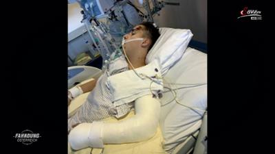 Fahndung Österreich: Fahrerflucht: Opfer im Koma