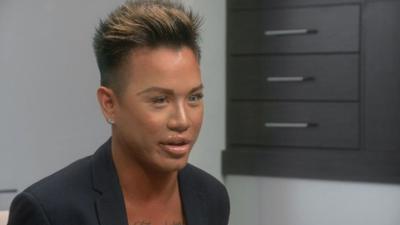 Verpfuscht - Ein Fall für die Beauty Docs: Staffel 4 Folge 16 Brust oder Keule