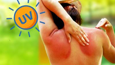 Spickzettel: Warum braucht unsere Haut Sonnenschutz? · Spickzettel