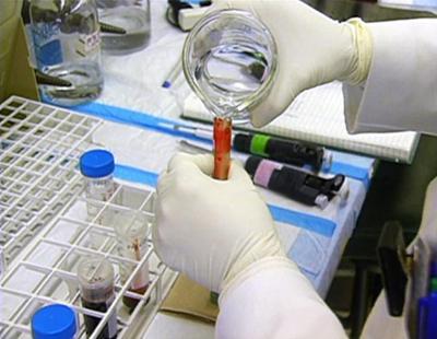 Medical Detectives: Staffel 1, Folge 27: Tödliche Substanzen