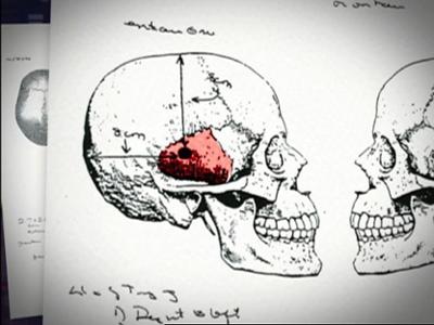 Medical Detectives: Staffel 1, Folge 139: Skrupellose Verlierer