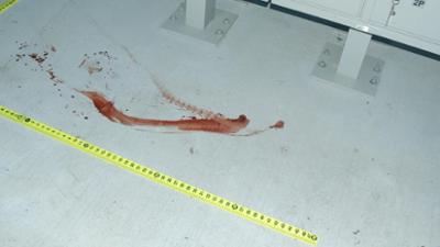 Medical Detectives: Staffel 3, Folge 3: Verdeckt