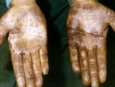 Medical Detectives: Staffel 1, Folge 86: Familienbande