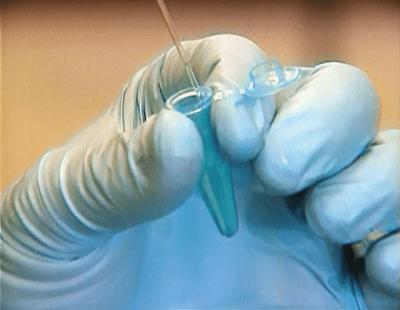 Medical Detectives: Staffel 1, Folge 39: Zeugen der Opfer