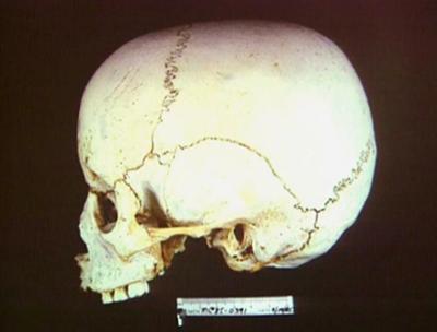 Medical Detectives: Staffel 1, Folge 66: Dem Täter auf der Spur