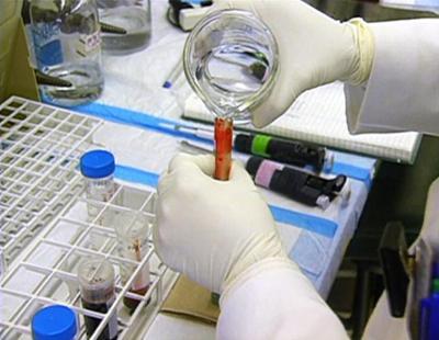 Medical Detectives: Staffel 1, Folge 27: Tödliche Substanzen