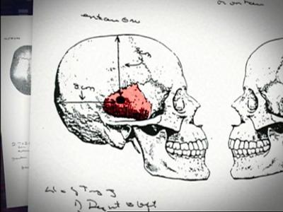 Medical Detectives: Staffel 1, Folge 139: Skrupellose Verlierer