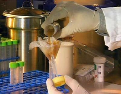 Medical Detectives: Staffel 1, Folge 30: Tödliche Bakterien