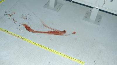 Medical Detectives: Staffel 3, Folge 3: Verdeckt