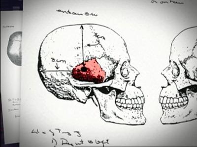 Medical Detectives: Staffel 1, Folge 139: Skrupellose Verlierer