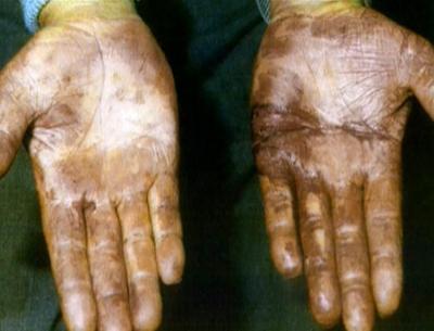 Medical Detectives: Staffel 1, Folge 86: Familienbande