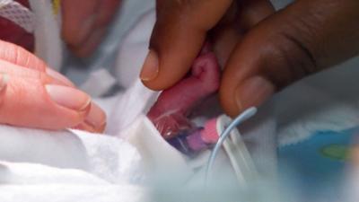 Kleines Leben - große Sorgen: Auf der Frühchenstation: Kleines Leben – große Sorgen: Auf der Frühchenstation
