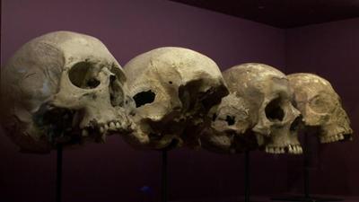 Mysterien des Mittelalters: Staffel 1, Folge 7: Die Totenschädel von Dornach