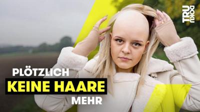 TRU DOKU: Im Urlaub: Leonie (22) verliert fast alle Haare - TRU DOKU